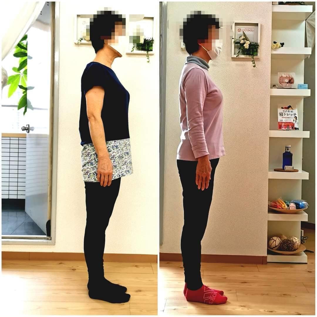 お客様ビフォーアフター④